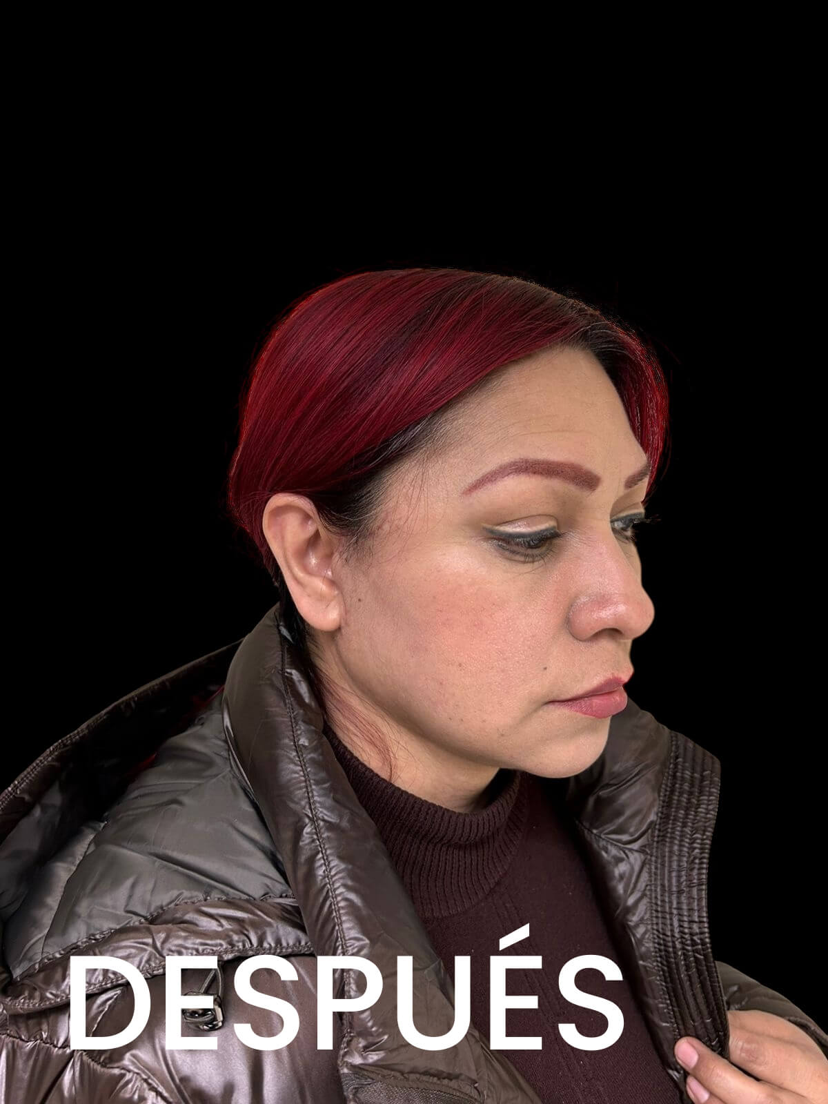 2. Imagen Despues 2 del Dr Alfredo Gomez