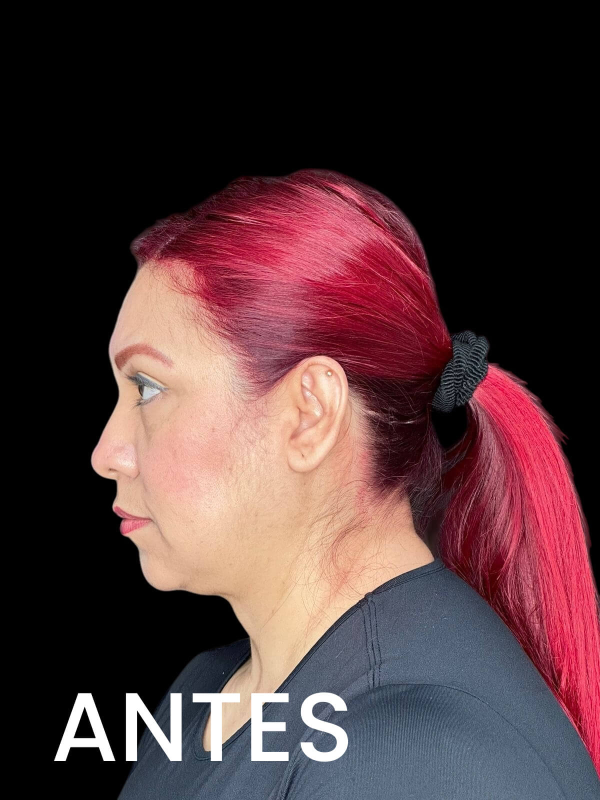 3. Imagen Antes 3 del Dr Alfredo Gomez