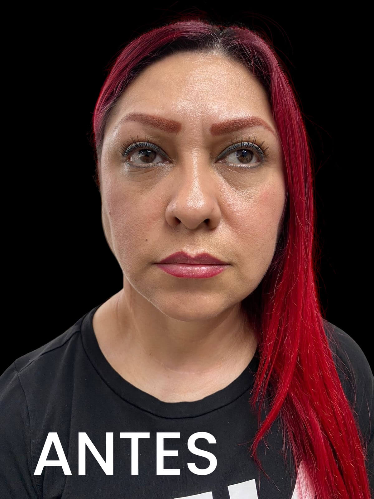 5. Imagen Antes 5 del Dr Alfredo Gomez