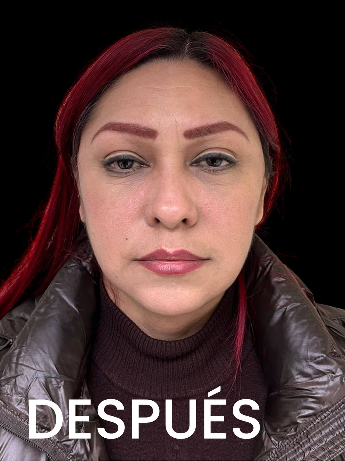 6. Imagen Despues 6 del Dr Alfredo Gomez